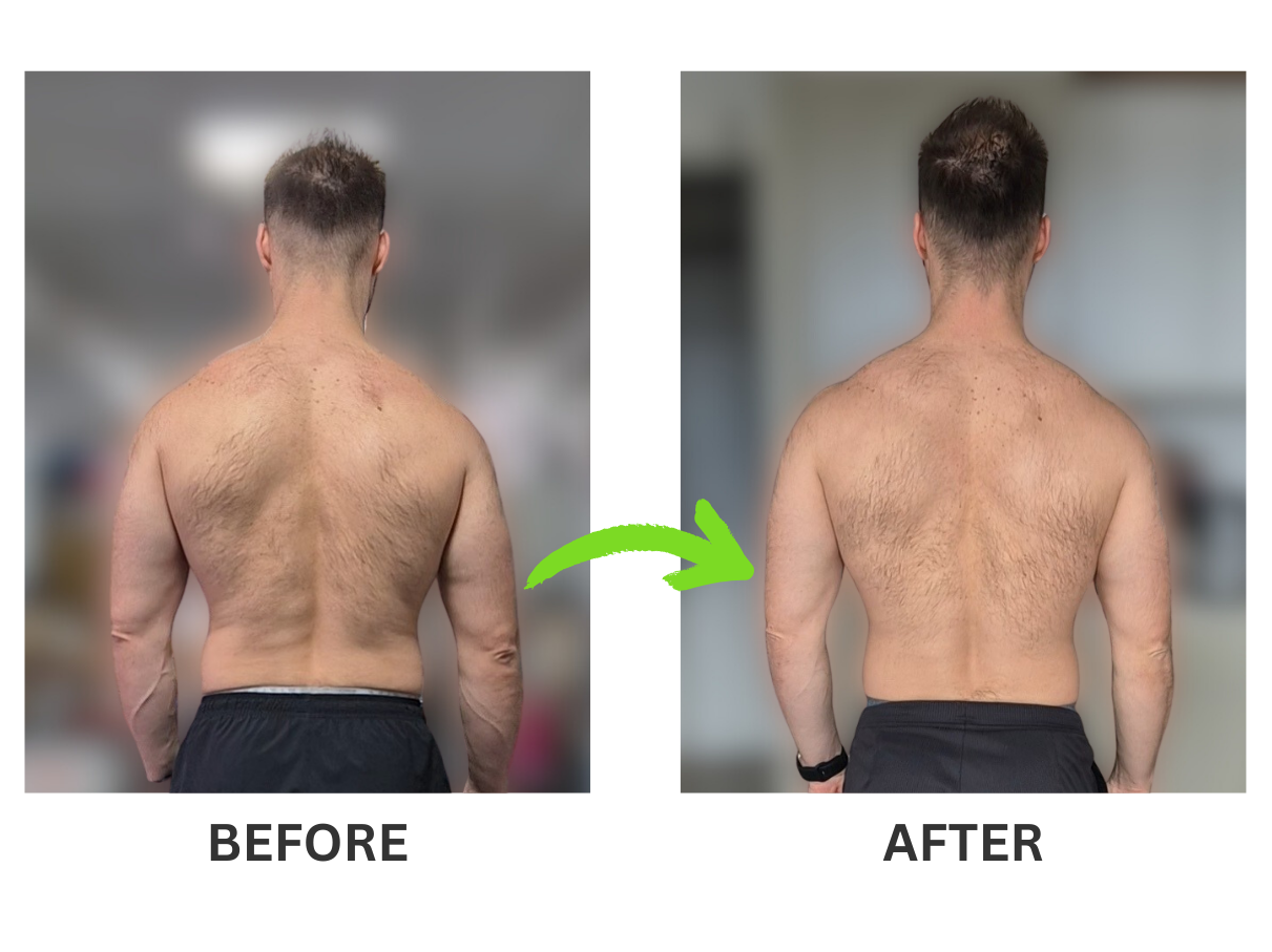 Claudiu-before-after-pictures